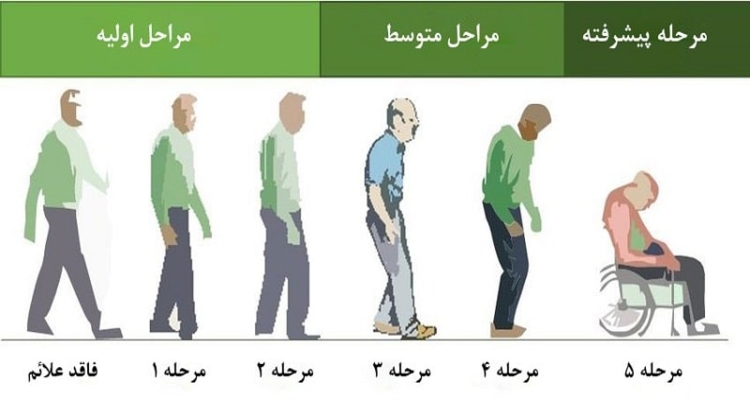 بیماری پارکینسون چیست؟ تشخیص و درمان توسط دکتر الهه محقق منتظری