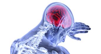دلایل سکته مغزی چیست؟ تشخیص و درمان + ویزیت آنلاین