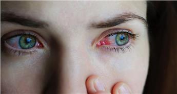 اختلالات بینایی - انواع مشکلات چشمی - تشخیص و درمان